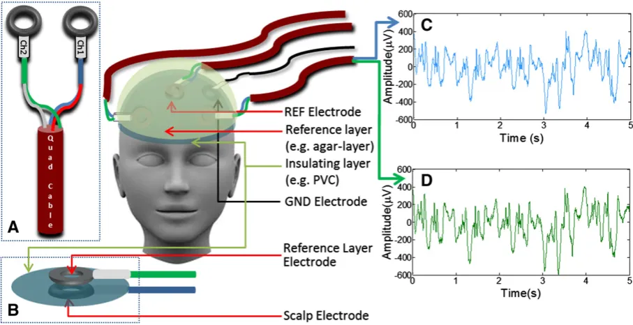 Fig. 1. Schematic representation of the reference layer experimental set-up. A: Electrode connections to star-quad cable; B: Electrode set-up on scalp and reference layers; EEG tracesrecorded simultaneously from C: phantom and D: reference channels during movement of the phantom.