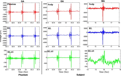 Fig. 4. Left column: EEG signal recorded from an electrode on the spherical phantom during the execution of the multi-slice EPI sequence (blue); re-referenced signal from the correspond-ing reference layer electrode (red); the difference of phantom and RL 