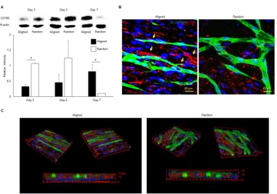 Figure 7. Influence of MMP-2/9 inhibitor APR100 on microvascular network formation. Aligned and randomly organized microvascular networks formed under 1 µM, 5 µM and 10 µM of APR100 after 7 days of EC culture