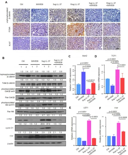 Figure 6. LL-37 is required for the activation of Wnt/ββand Ki67 in C57BL/6 mice inoculated with 2-catenin signaling