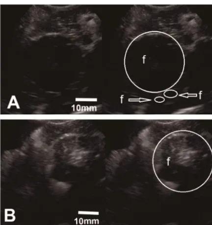 Figure 2 shows the ultrasonogram of hen’s ovary that scanned at left and right side of hen's body