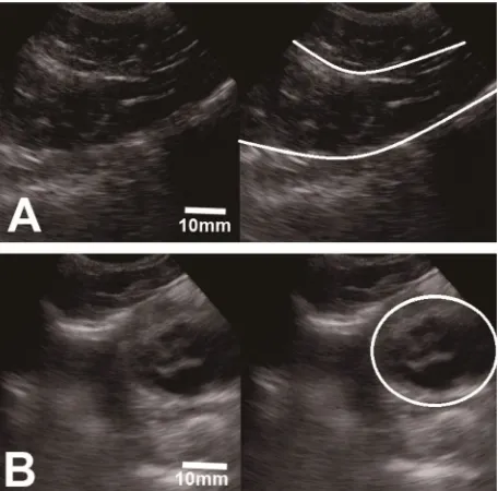 Figure 5.  Ultrasonogram of hens’ uterine with longitudinal (A) and transversal (B) view scanning 