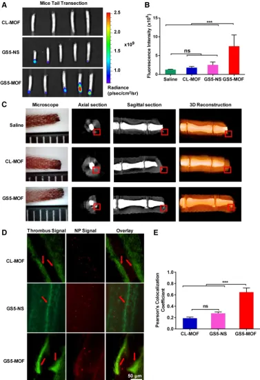 Figure 6. In vivo targeting efficiency of GS5-MOF nanoparticles to vascular injuries in a mouse tail transection model and a mouse mesenteric thrombosis model