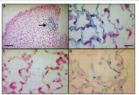 Figure 4. Transdiff erentiation of mesenchymal stem cells. Photomicrographs of murine lung demonstrating engraftment of mesenchymal stem cells, which are stained blue due to their expression of the Lac-Z transgene, into the mouse lung following bleomycin-i