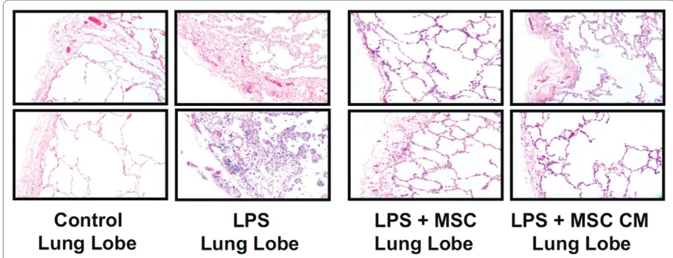 Figure 6. Human mesenchymal stem cells reduce endotoxin-induced injury in the human lung