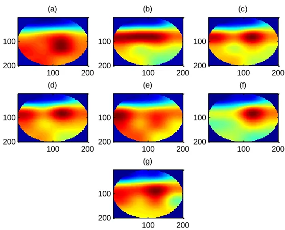 Fig. 7: Brain map of Relative Power of Beta Sub-band in 7 states: (a) Silence, (b) 196 Hz, (c) 392 Hz, (d) 784 Hz, (e) 1568 Hz, (f) 3136 Hz and (g) 6272 Hz 