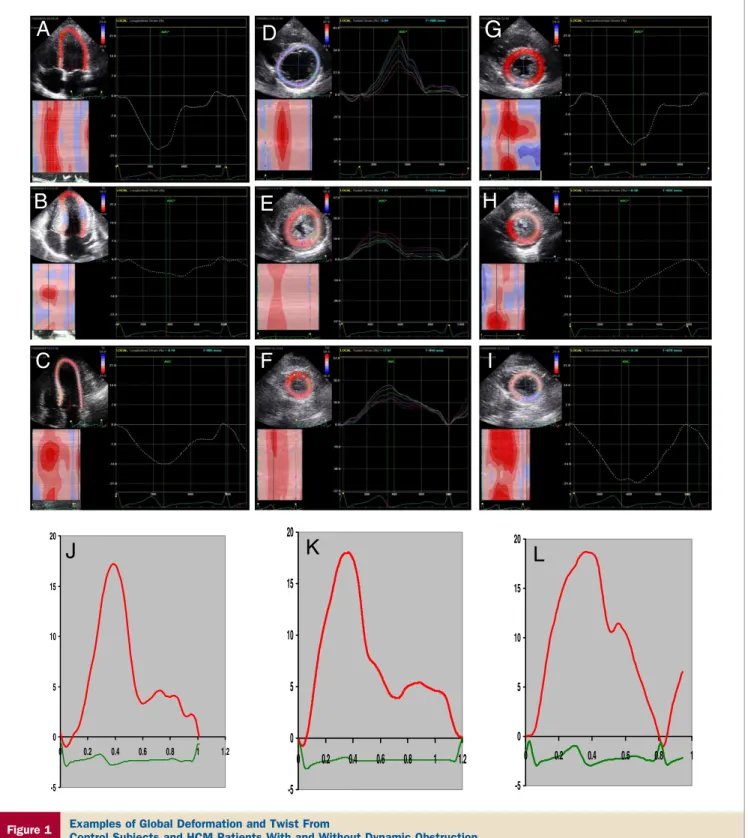 Figure 1 Examples of Global Deformation and Twist From