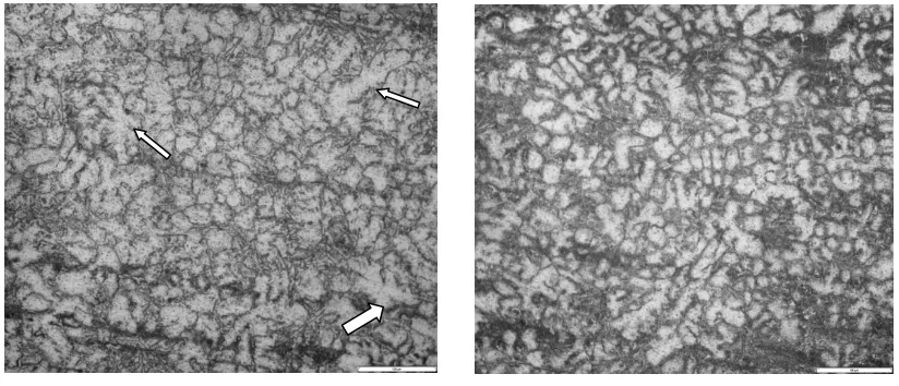 Fig. 6. Microstructure obtained with pouring temperature at 6500Left: cooling length 200 mm, right: cooling length 300 mm, both with cooling slope angle 45 C; 0 