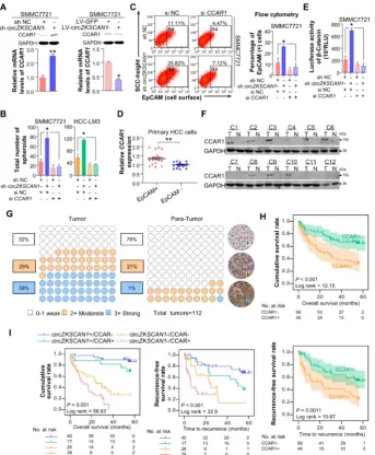 Figure 5. FMRP modulates cellular stemeness in HCC through its target gene, CCAR1 which assists in the activation of Wnt/βCCAR1 was measured by immunohistochemistry staining using a pair of tissue microarrays (n=112)