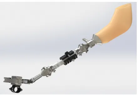 Figure 6. Final prosthesis design (assembled view). 