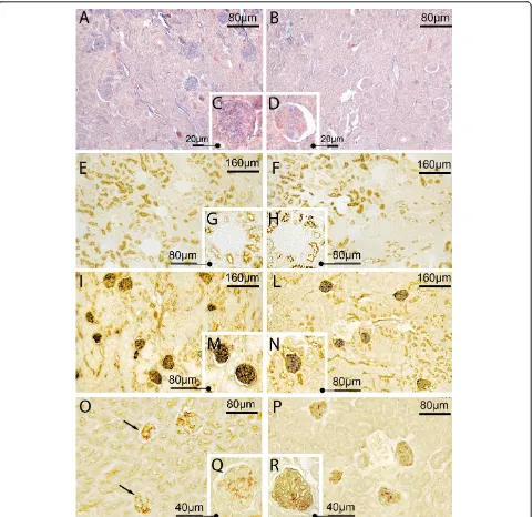 Figure 4 Sepsis was associated with reduced expression and changes in chemical structure of glomerular sialic acids