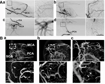 Figure 2. Collateral perfusion in the rat deep brain after MCAO. A) Dynamic sagittal SR angiographic images of collateral perfusion taken before MCAO (the collaterals perfused between the MCA and PCA in the deep brain