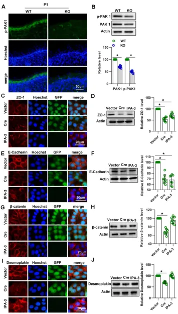 Figure 6. Cdc42 affect the expression of E-cadherin and ZO-1 through PAK1. ((5 Cdc42. (A) IF detection of PAK1 in the epidermis of KO and WT mice at E15.5, E17.5 and P1 B) The epidermis was isolated from P1 WT and KO mice, and the expression of PAK1 and p-