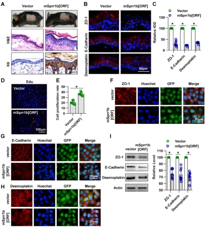 Figure 8. Overexpression of SPRR family members cause abnormal cell junctions. (A) The lentivirus vectors and mSprr1b[ORF045957] were applied to mouse skin