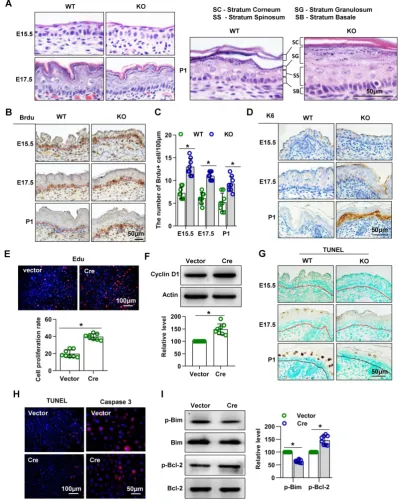 Figure 3. Mice lacking Cdc42 show abnormal proliferation and apoptosis. (Primary keratinocytes were isolated from P1 Cdc42A) H&E staining of control and Cdc42 KO mice at E15.5, E17.5 and P1