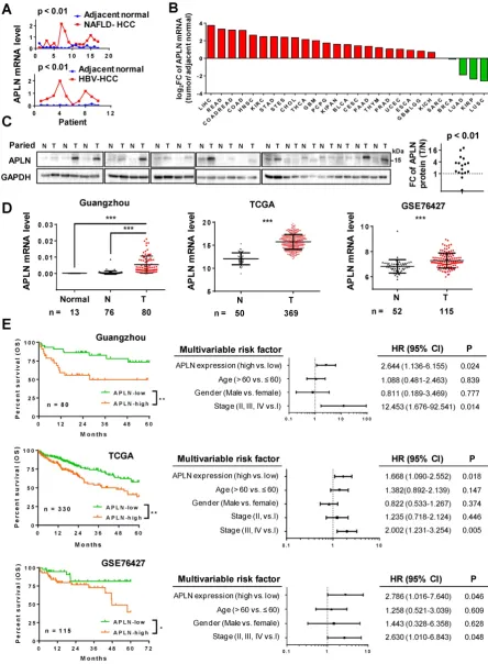 Figure 1. APLN is overexpressed in HCC tissues and (http://firebrowse.org). Full name of cancer-type abbreviations and their sample sizes are provided in Table S1