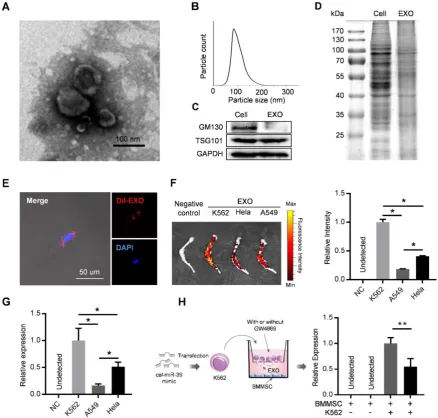 Figure 2. Leukemia cell-secreted exosomes are efficiently taken up by BMMSC. (A) Transmission electron microscopy images of exosomes derived from K562 cells