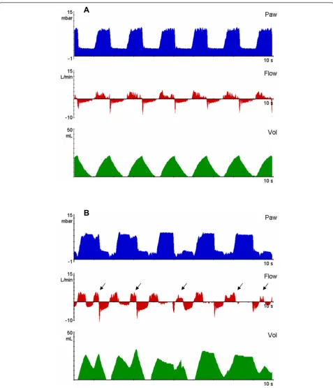 Figure 2 Representative recordings of airway pressure (Paw), flow and volume (Vol) in experimental groupsequal I:E ratio (1:1), Pcontrol ventilation; PEEP, positive end-expiration pressure; P