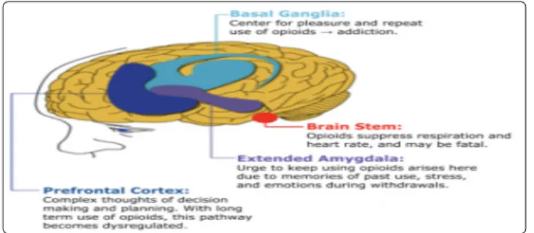 Figure 2: Drugs of abuse alter basal ganglia, extended amygdala,  and prefrontal cortex resulting in compulsive drug use that marks  the addiction [19]