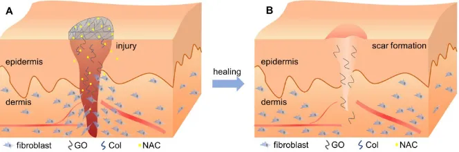 Figure 10. Schematic diagram of the healing procedure of N-Col-GO in wound model. (A) Sustained release of NAC by the N-Col-GO membrane reduces the cytotoxicity of GO and leads to increased migration and adherence of fibroblasts in the early phase of injur