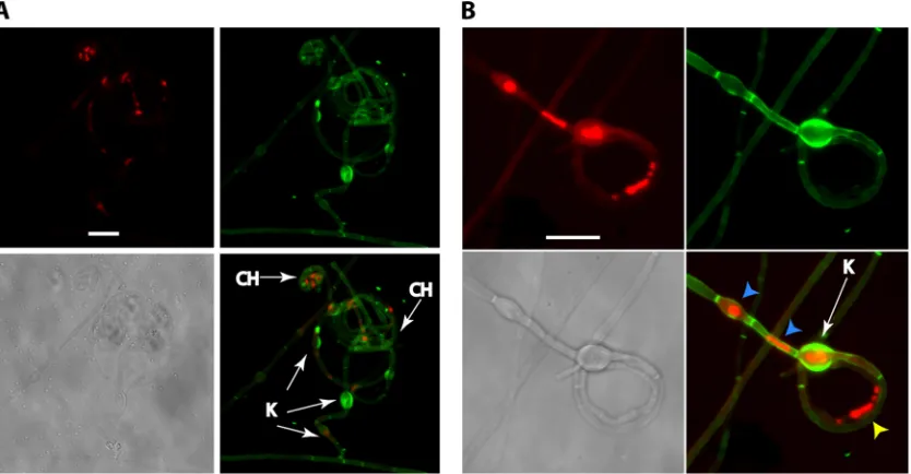 FIG 5 Confocal microscopy examination of Paracoccidioides species sexual structures. Samples from mating experiments using SEA medium and JAL � EE cocultures(P