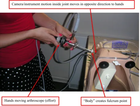 Figure 1: Shoulder scope (on a plastic shoulder model) showing the hand position, fulcrum 