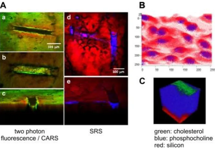 Figure 4. Illustraation of case studies. A. Comparison of fluorescence and Raman imaging techniques to study the localisation of nanoparticles (40 nm diameter) in porated skin