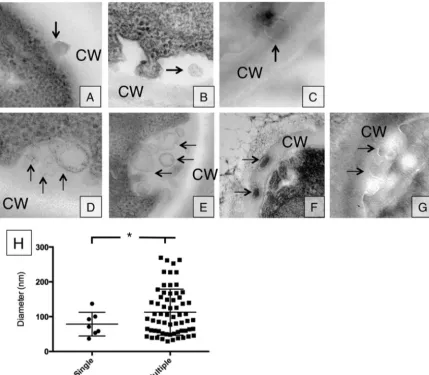 FIG 1 Vesicle release occurs in either single or multiple release events. (A to G) Single vesicle release events (A to C) as well as multiple vesicle release events (Dto G) were observed in TEM section