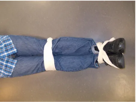 Figure 3- leg splinting 