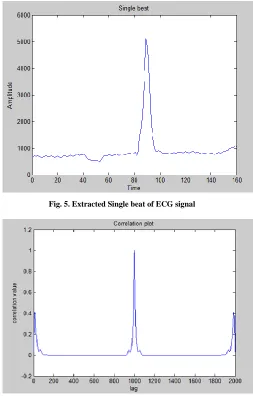Fig. 5. Extracted Single beat of ECG signal 