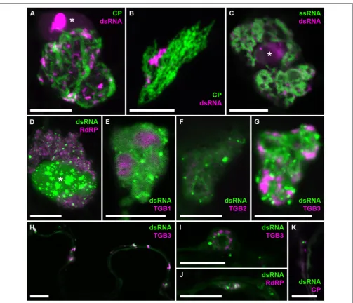 FIGURE 8 | Co-localization of dsRNA with components of PVX infection. B2:RFPco-localize with the dsRNA marker, although RdRP and TGB3 show granular locations within the X-body as well