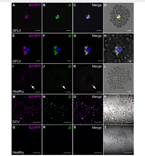 FIGURE 3 | Speciﬁc detection of viral dsRNA-species by ﬂuorescence labeling(detected viral dsRNA species in plant protoplastsDCV-infected in situ