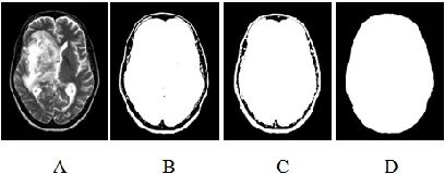 Figure 2: An example for MRI brain scanning image segmentation, A) Original MRI image,   B) Segmented MRI image with threshold equal to 25, C) Dilated MRI image, and  D) Filled holes image