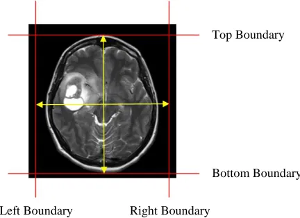 Figure 4: MRI brain scanning image cropping. 