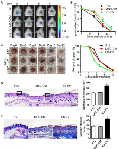 Figure 5. Enhanced wound-healing process of senescent MSCs by ES-EVs. (A)(D) Histologic analysis of wound area by HE staining
