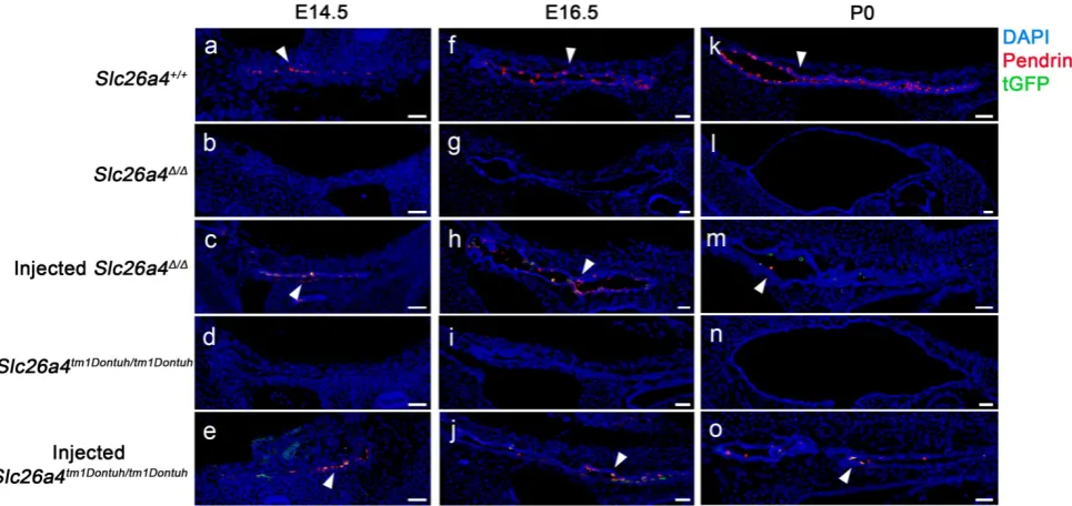 Figure 2. Pendrin and tGFP protein expression in the endolymphatic sac. Pendrin immunoreactivity (red) and direct fluorescence of tGFP (green) were evaluated in endolymphatic sacs of Slc26a4+/+, Slc26a4Δ/Δ, injected Slc26a4Δ/Δ, Slc26a4tm1Dontuh/tm1Dontuh, 