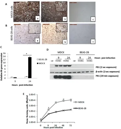 Figure 1. BEAS-2B cells were considerably less permissive to influenza virus replication than MDCK cells