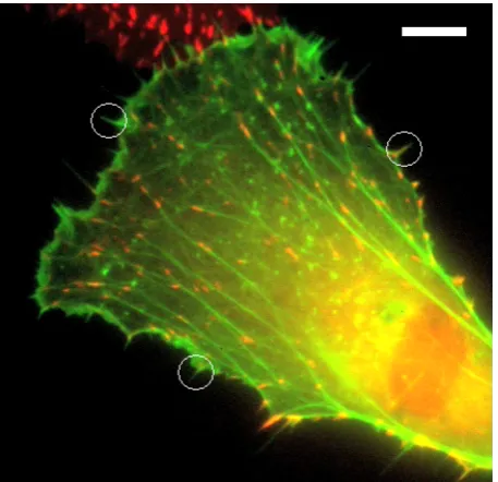Figure 1.10: Fluorescent image of a goldsh broblast tagged with actin-GFP. The net-work structure of the actin laments is visible in the cell body, but also visible are thelopodia protruding from the edge of the membrane