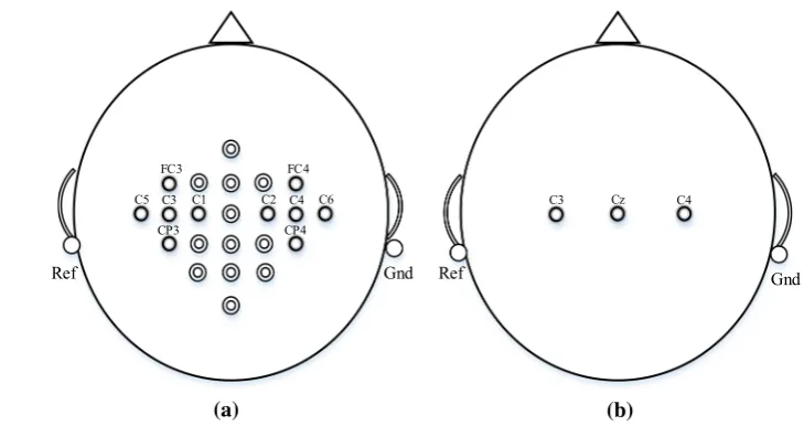 Fig. 3 Electrode montage