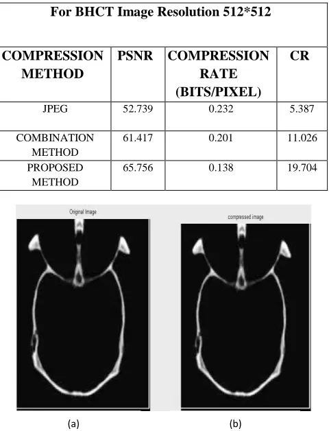 Figure 6: The Comparative Analysis of CR Value of BHCT Image. 