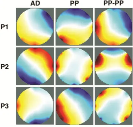 Fig. 4. Reconstructed images for diﬀerent drive patterns in the case of P1, P2 and P3 load