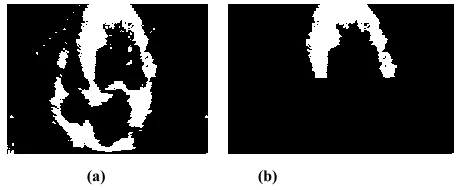 Fig. IV: - Output after the preprocessing 