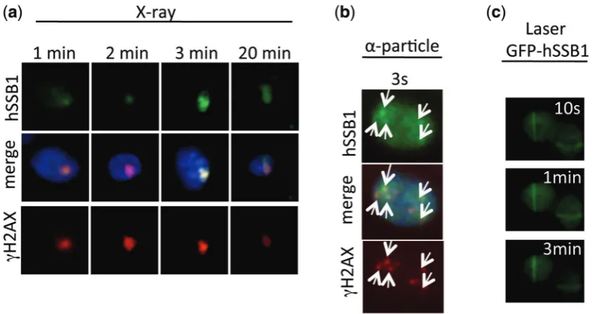 Figure 1. hSSB1 localizes to sites of DSBs. (were treated with 6 Gy IR, at indicated time points and non-chromatin bound proteins extracted