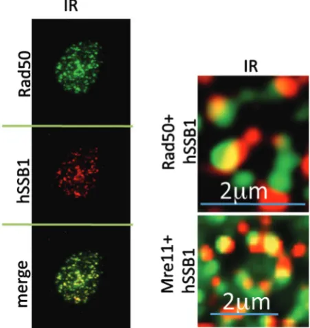 Figure 3. hSSB1 localizes with components of the MRN complexwithin 15 min of IR. Immunostaining showing co-localization ofhSSB1 with Rad50 and Mre11 in MCF7 cells treated with 6 Gy IR.Afterpre-extracted NP40 buffer before ﬁxation and staining as describedp