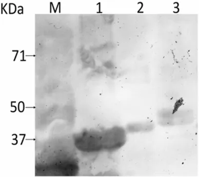 Figure 3. SDS-PAGE analysis of purified recombinant proteins expressed in E. Coli BL21