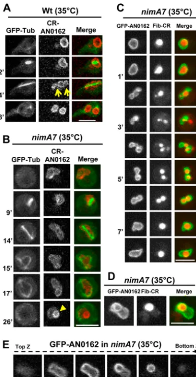 FIG 3 Defective NE dynamics and nucleolar segregation in cells with partialMG227) cells