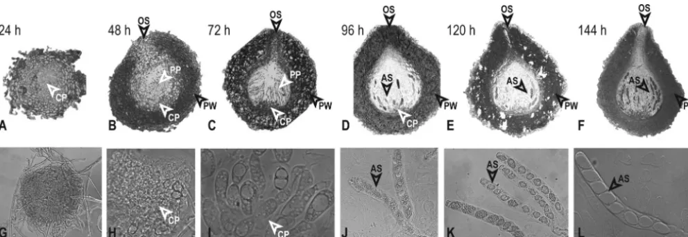 FIG 1 Analysis of perithecial development inthick-walled cells, and the development of thin-walled cells in the centrum parenchyma (CP), except as noted