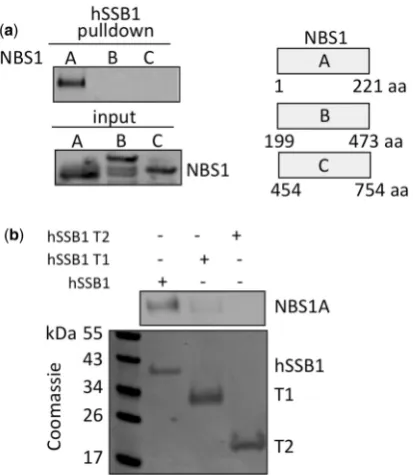 Figure 5. Nijmegen breakage syndrome mutants fail to interact efﬁ-ciently with hSSB1. (a) Pull-down reactions were performed usinghSSB1 bound to sepharose incubated with NBS1A, or NBS1A withthe mutations I171V or R215W in the BRCT domain and immuno-blotted