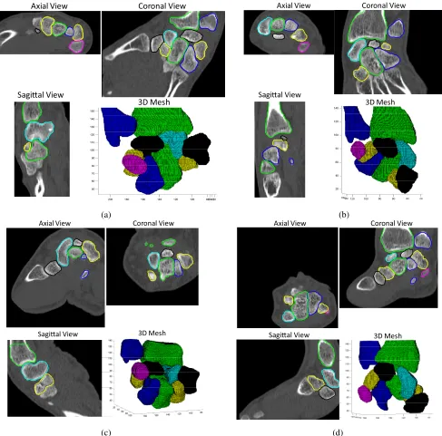 Fig. 8.The axial view, coronal view, sagittal view and 3D mesh model of automatically segmented wrists at (a) Radial deviation (b) Ulnar deviation (c)ﬂexion (d) Extension positions of different subjects