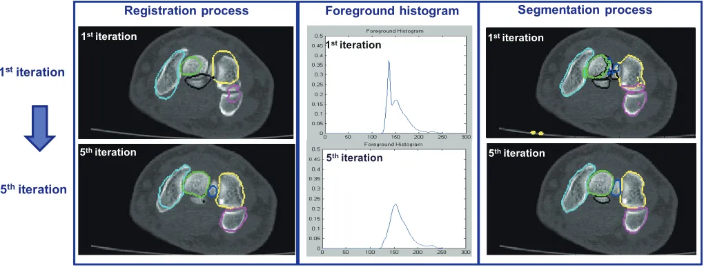 Fig. 5.Process of integrated segmentation-registration iteration for registering the template volume (coloured contours) to a target volume of a differentsubject